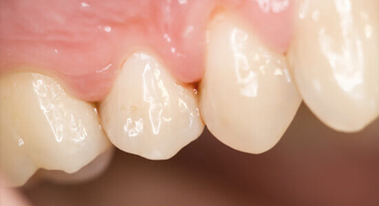 福岡駅・山下歯科・技術力