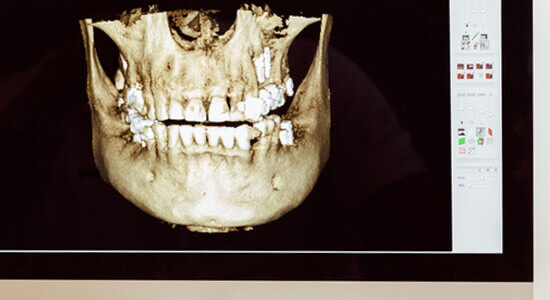 福岡駅・山下歯科・安全重視の施術
