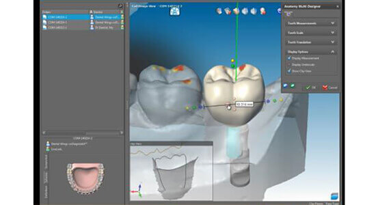福岡駅・山下歯科・術後のケア