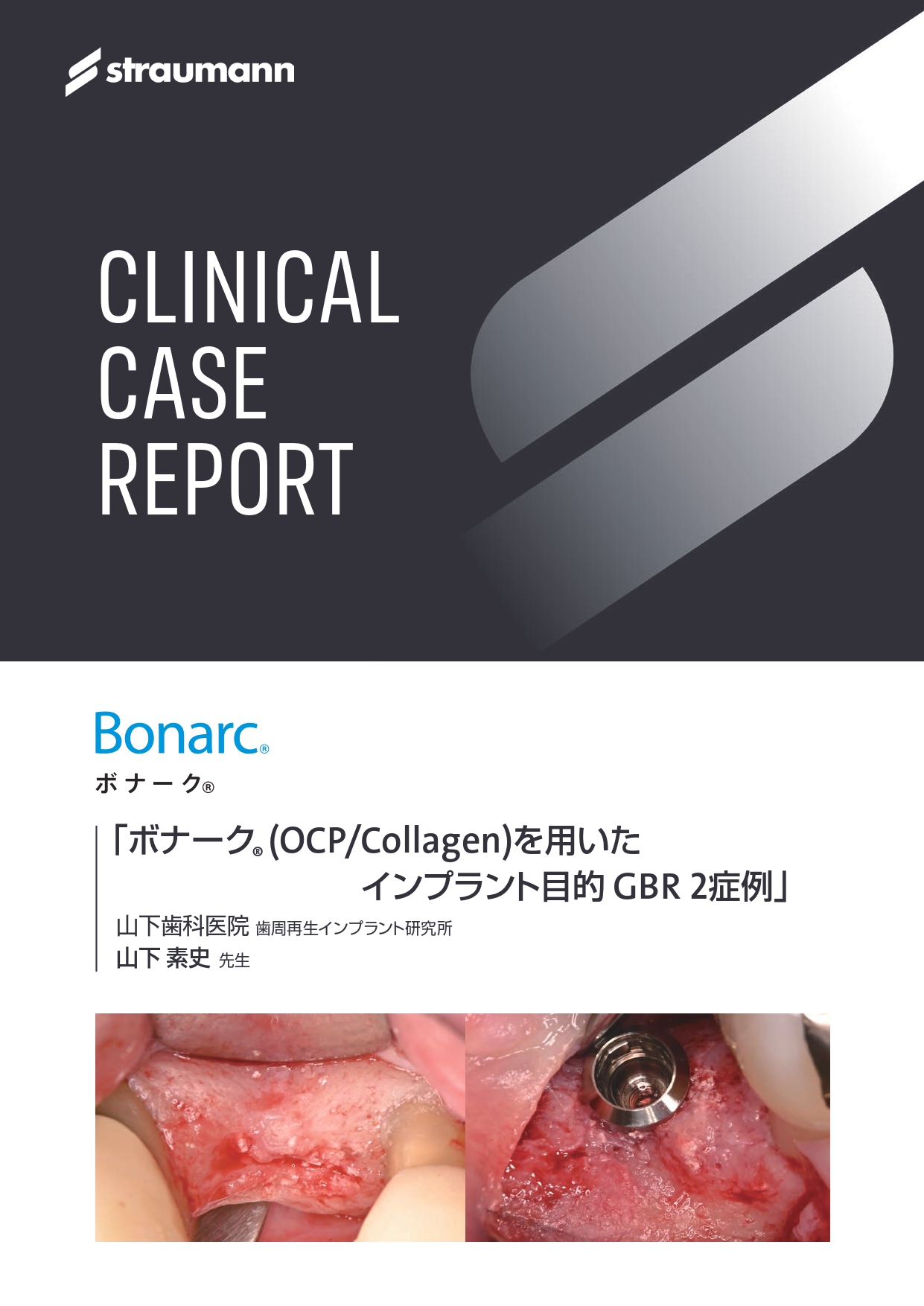 ケースレポート